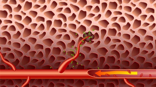 Anti-Angiogenesis Cancer Treatment Animation